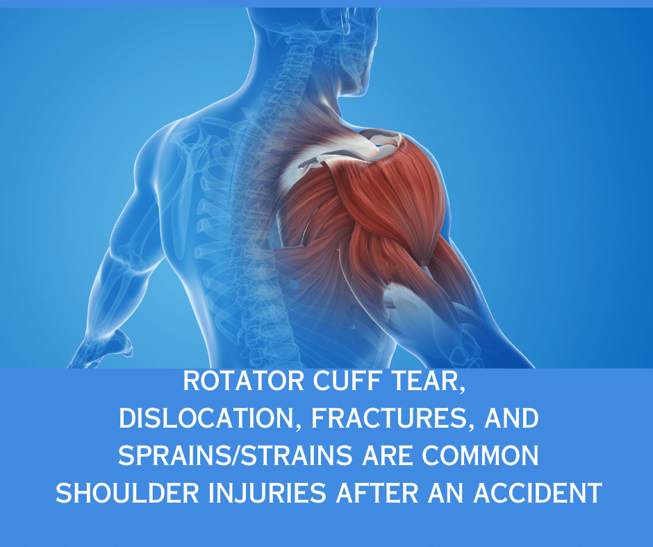 Shoulder injuries after a car accident or slip and fall.